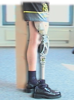 prosthetic leg image