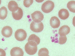Picture of Platelets